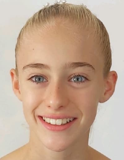 Anais Esseldeurs — Classical dancer, Belgium