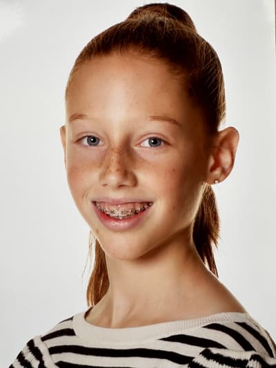 Margaux Barbe — Classical dancer, Belgium