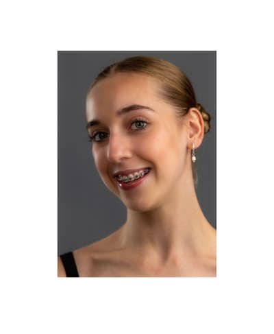 Imogen Chapman — Classical dancer, Australia