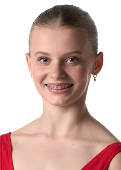 Sienna Leary — Classical dancer, Australia