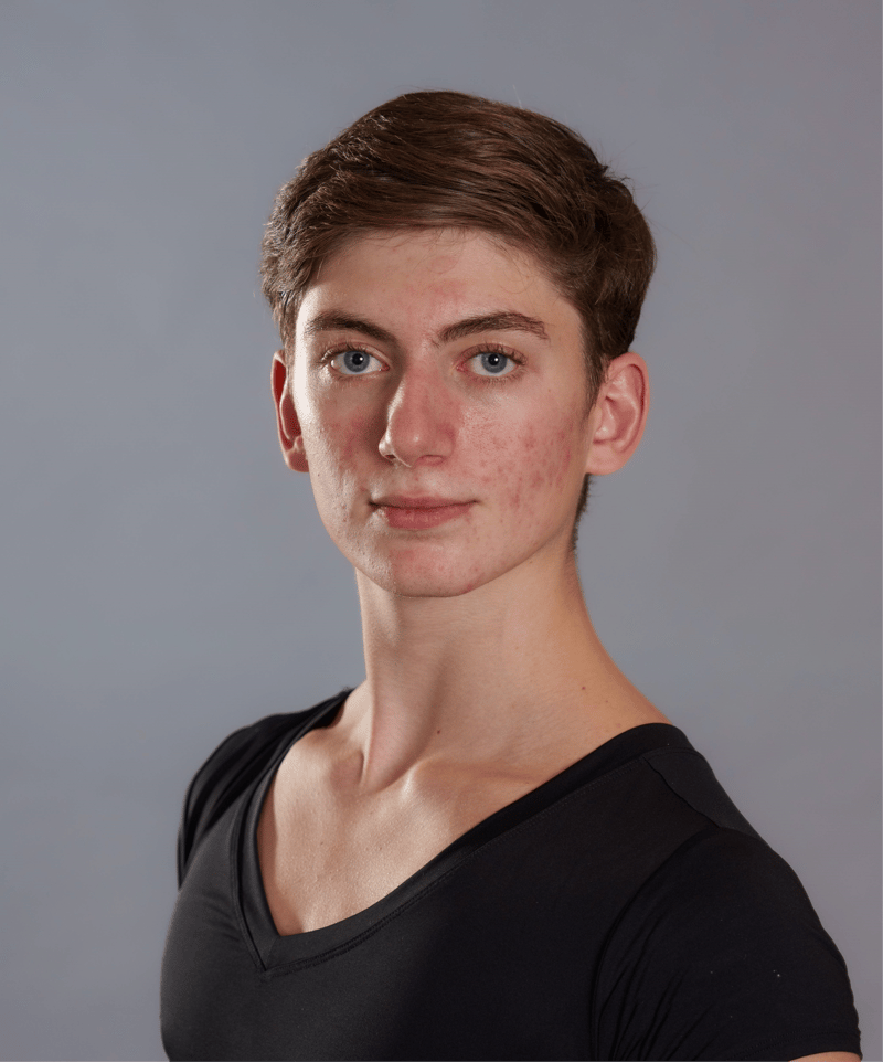 Benedetto Fenni — Classical dancer, Germany