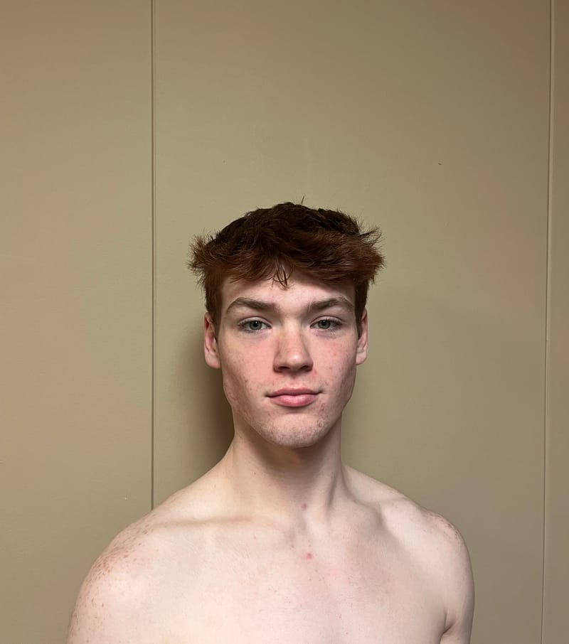 Shawn Pearson — Classical dancer, United States